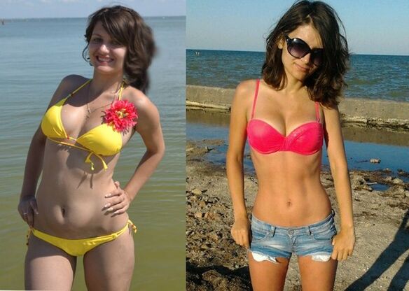 Anna giảm 10 kg với NexaSlim